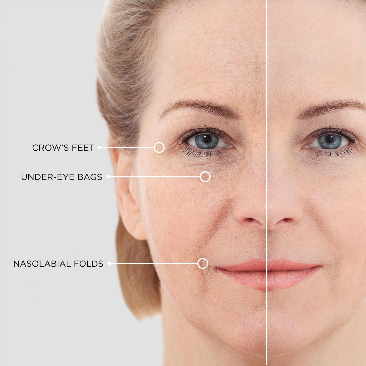 GLOWLIFT® Patches